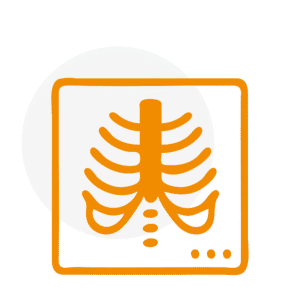 Symbolbild für digitale Röntgendiagnostik der Knochenstruktur
